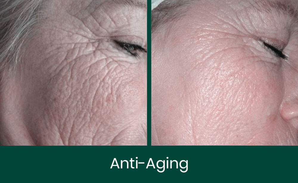 Anti-Aging