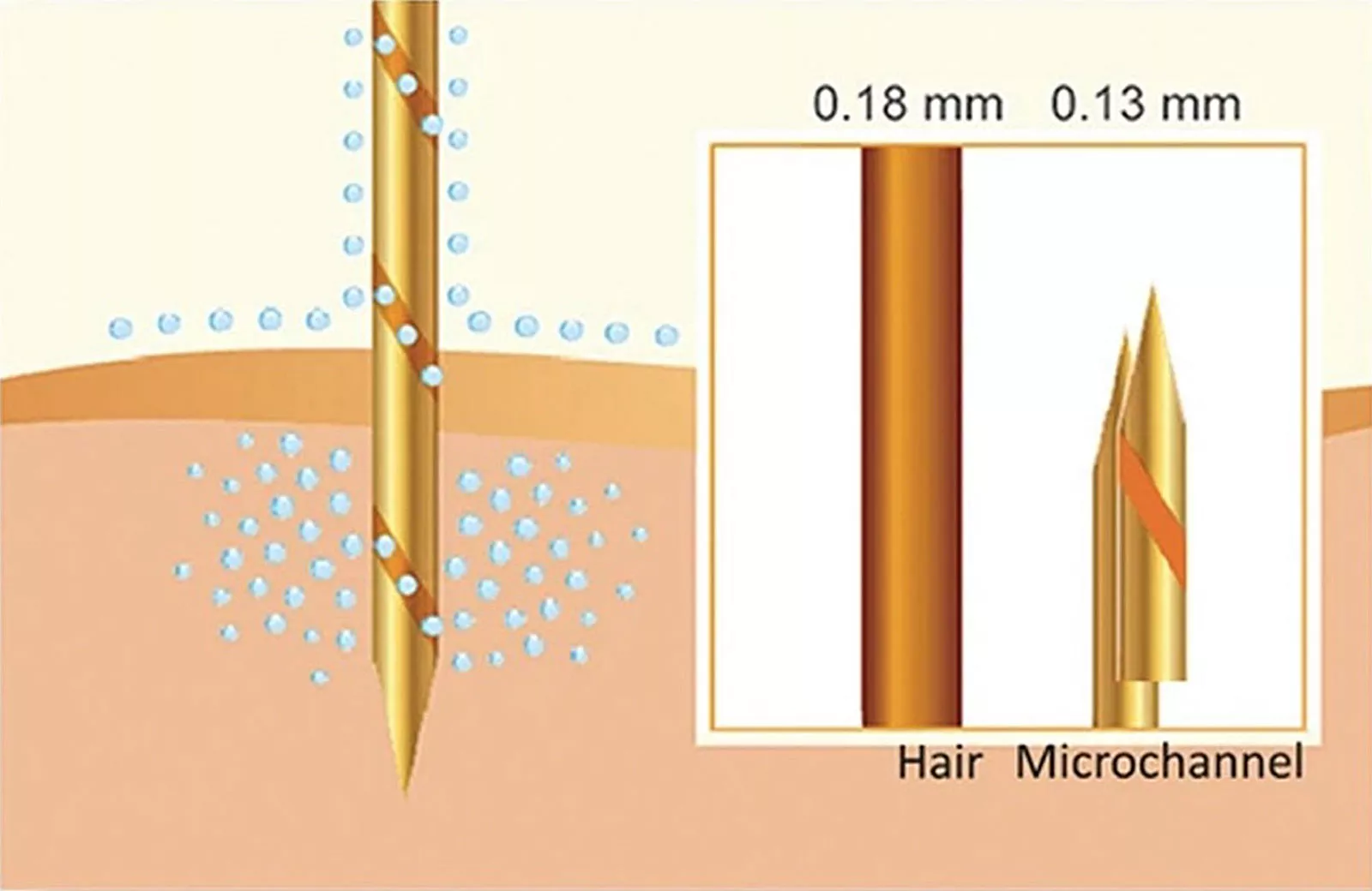 Aqua-Gold-Technologie sind mikroskopisch feine, vergoldete Nadeln